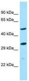 ALG10 Alpha-1,2-Glucosyltransferase B antibody, TA334399, Origene, Western Blot image 