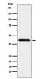 Cystathionine Gamma-Lyase antibody, M01803-1, Boster Biological Technology, Western Blot image 