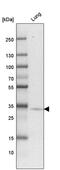 3-Hydroxyacyl-CoA Dehydratase 4 antibody, PA5-63602, Invitrogen Antibodies, Western Blot image 
