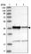 Zinc Finger CCCH-Type Containing 8 antibody, HPA034804, Atlas Antibodies, Western Blot image 