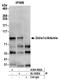Protein artemis antibody, A304-902A, Bethyl Labs, Immunoprecipitation image 