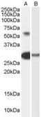 ICAM5 precursor antibody, orb19347, Biorbyt, Western Blot image 