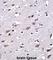 Cellular Repressor Of E1A Stimulated Genes 2 antibody, abx027814, Abbexa, Western Blot image 