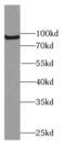 Complement C4-A antibody, FNab01111, FineTest, Western Blot image 