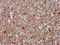 Cytoskeleton Associated Protein 5 antibody, LS-C671780, Lifespan Biosciences, Immunohistochemistry paraffin image 