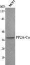 Protein Phosphatase 2 Catalytic Subunit Alpha antibody, STJ98535, St John