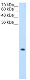 Mitochondrial Ribosomal Protein S12 antibody, TA339353, Origene, Western Blot image 