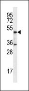 DSN1 Component Of MIS12 Kinetochore Complex antibody, 56-671, ProSci, Western Blot image 