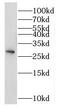 NSE2 (MMS21) Homolog, SMC5-SMC6 Complex SUMO Ligase antibody, FNab05869, FineTest, Western Blot image 