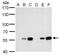 Carbonic Anhydrase 9 antibody, GTX629747, GeneTex, Western Blot image 