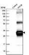 HscB Mitochondrial Iron-Sulfur Cluster Cochaperone antibody, NBP1-84066, Novus Biologicals, Western Blot image 