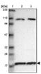Ribosomal Protein L12 antibody, NBP1-82857, Novus Biologicals, Western Blot image 
