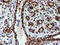 Peptidyl Arginine Deiminase 4 antibody, TA504813, Origene, Immunohistochemistry frozen image 