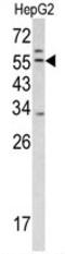 Transmembrane Serine Protease 2 antibody, AP17792PU-N, Origene, Western Blot image 