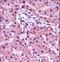 Histone Cluster 1 H1 Family Member E antibody, LS-C166886, Lifespan Biosciences, Immunohistochemistry frozen image 