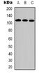Dihydropyrimidine dehydrogenase [NADP+] antibody, LS-C368950, Lifespan Biosciences, Western Blot image 