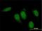 Titin antibody, H00007273-M01, Novus Biologicals, Immunocytochemistry image 