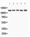 Complement C5 antibody, LS-C313394, Lifespan Biosciences, Western Blot image 