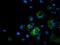 Metabolism Of Cobalamin Associated A antibody, MA5-25384, Invitrogen Antibodies, Immunocytochemistry image 