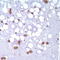 Integrin beta-3 antibody, TA327648, Origene, Immunohistochemistry paraffin image 