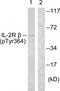 Interleukin-2 receptor subunit beta antibody, TA314069, Origene, Western Blot image 