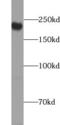 Dedicator of cytokinesis protein 7 antibody, FNab02497, FineTest, Western Blot image 