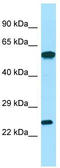 Deoxyguanosine kinase, mitochondrial antibody, TA337928, Origene, Western Blot image 