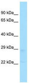 TPD52 Like 2 antibody, TA343196, Origene, Western Blot image 