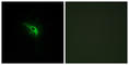 Tumor Protein P53 Regulated Apoptosis Inducing Protein 1 antibody, abx014062, Abbexa, Western Blot image 
