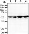 Pyruvate Dehydrogenase Complex Component X antibody, GTX57725, GeneTex, Western Blot image 