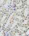 POP4 Homolog, Ribonuclease P/MRP Subunit antibody, FNab06641, FineTest, Immunohistochemistry paraffin image 