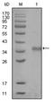 Nuclear Receptor Corepressor 1 antibody, AM06272SU-N, Origene, Western Blot image 