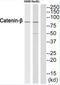 Catenin Beta 1 antibody, TA313138, Origene, Western Blot image 