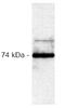 RAF proto-oncogene serine/threonine-protein kinase antibody, AM00132PU-N, Origene, Western Blot image 
