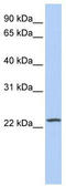 PtdIns(4)P-5-kinase-like protein 1 antibody, TA337786, Origene, Western Blot image 