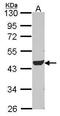 Adenylosuccinate lyase antibody, GTX114243, GeneTex, Western Blot image 