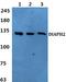 Diaphanous Related Formin 2 antibody, A07378-1, Boster Biological Technology, Western Blot image 