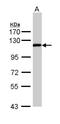 Zinc Fingers And Homeoboxes 2 antibody, NBP1-33415, Novus Biologicals, Western Blot image 