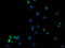 SSX Family Member 1 antibody, TA502693, Origene, Immunofluorescence image 