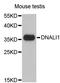Dynein Axonemal Light Intermediate Chain 1 antibody, abx003099, Abbexa, Western Blot image 