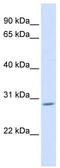 Zinc finger protein AEBP2 antibody, TA329327, Origene, Western Blot image 