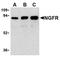 p75 ICD antibody, AP05556PU-N, Origene, Western Blot image 