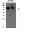 Complement C8 Beta Chain antibody, A07152, Boster Biological Technology, Western Blot image 
