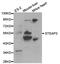 STEAP3 Metalloreductase antibody, TA326846, Origene, Western Blot image 