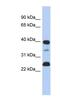 Thymopoietin antibody, NBP1-59402, Novus Biologicals, Western Blot image 
