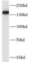 Glutamyl-Prolyl-TRNA Synthetase antibody, FNab02817, FineTest, Western Blot image 