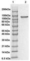 Protein Tyrosine Kinase 2 antibody, TA354484, Origene, Western Blot image 