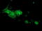 Dystrobrevin Alpha antibody, LS-C785441, Lifespan Biosciences, Immunofluorescence image 