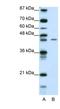 Zinc Finger Protein 17 antibody, NBP1-80317, Novus Biologicals, Western Blot image 