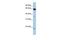 Homeobox And Leucine Zipper Encoding antibody, GTX49022, GeneTex, Western Blot image 